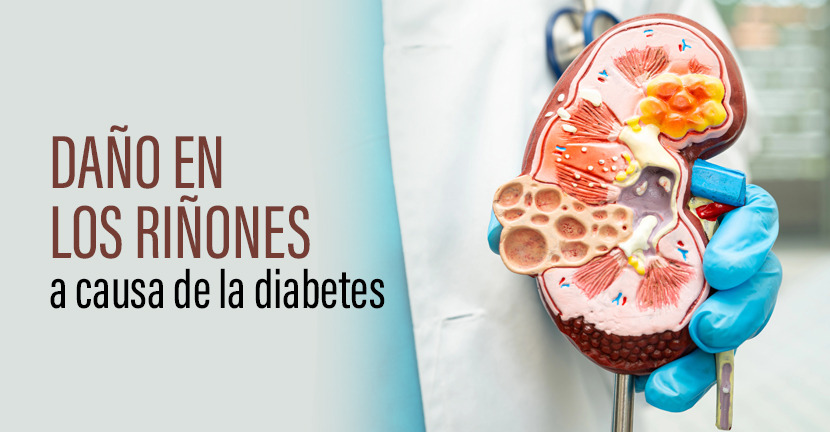 Daño en los riñones a causa de la diabetes.